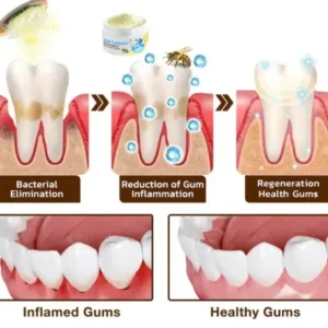 AQA™ Focussmile Bee Venom Treatment Oral Powder