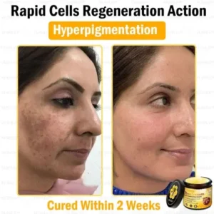 Special Sale VLSVLS™ Bee Venom Skin Restoration Cream