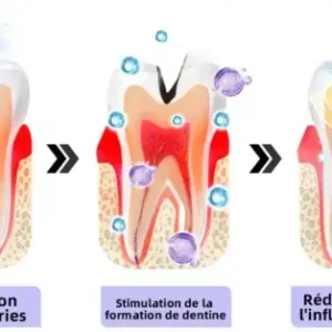 Winter Sale Oyikey™ Teeth Restoration Poudre Minérale